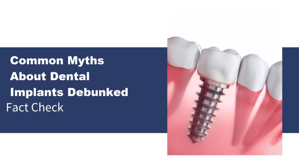 myths-about-dental-implants.jpegs_-scaled-d25d02a7