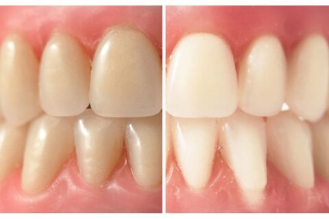 The Importance of Brushing Teeth Before Breakfast - jhoo jhoo